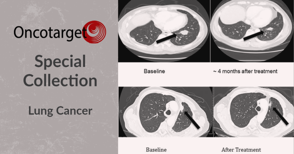 Oncotarget Special Collection: Lung Cancer