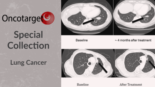 Oncotarget Special Collection: Lung Cancer