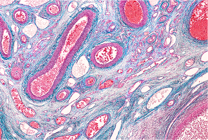 Anatomy and physiology of Ovary under the microscopic in laboratory.