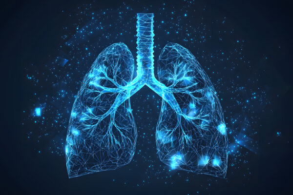 Lung cancer